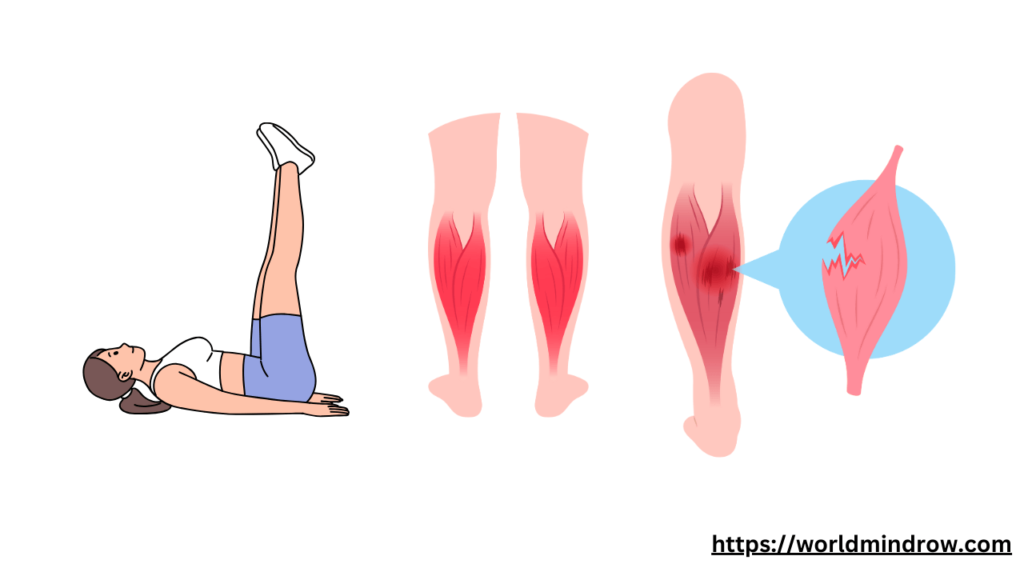 Calf Strain Exercises